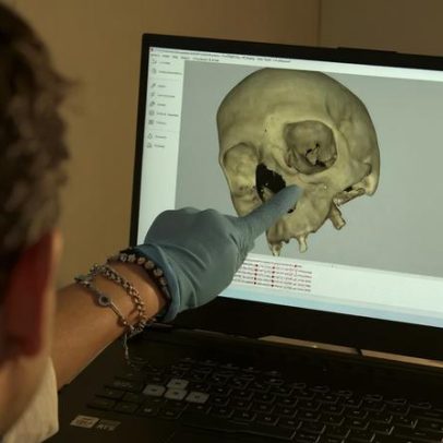 Universidade de Aveiro desenvolve substitutos ósseos via impressão 3D