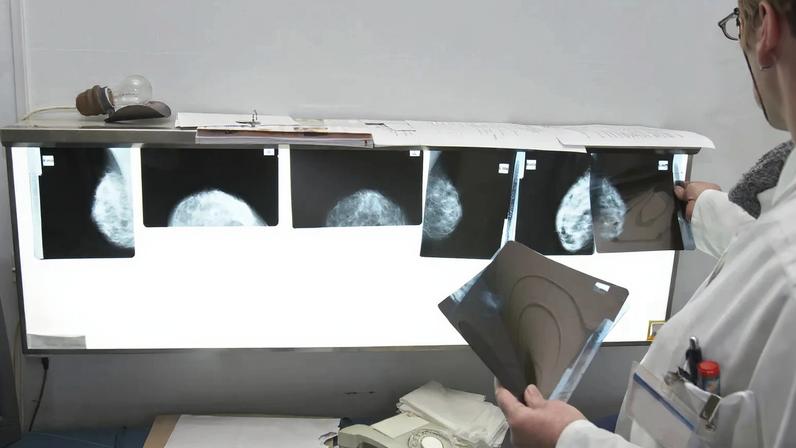 Radiologia, Raio-x, radiografias