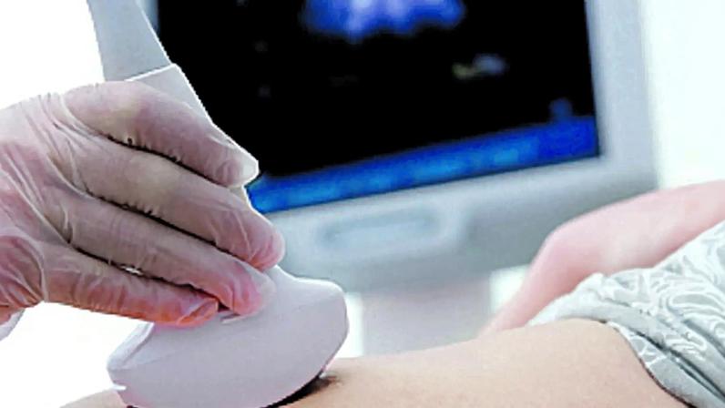 Exames na gravidez são essenciais para detetar anomalias congénitas