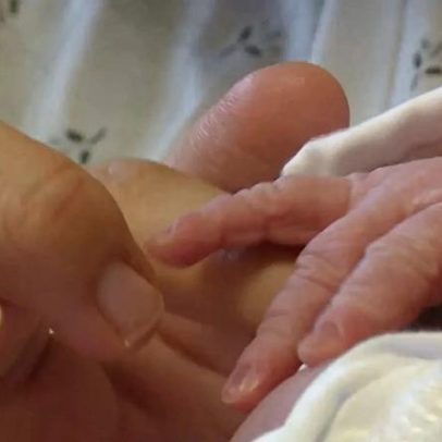 Terceiro bebé morre em França após leite contaminado