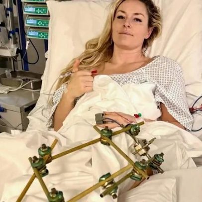 Terceira cirurgia de Lindsey Vonn foi bem-sucedida