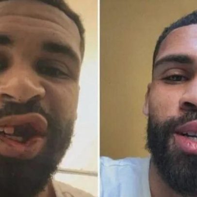 Loftus-Cheek operado a fratura do maxilar e fica dois meses afastado