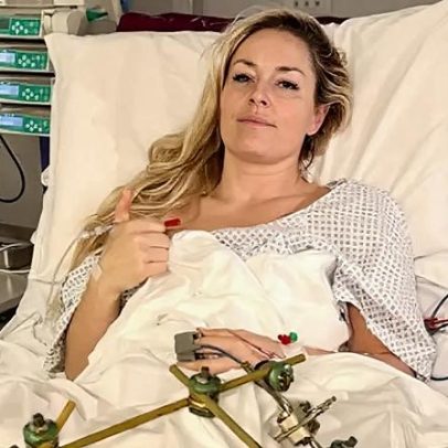 Lindsey Vonn diz que o cirurgião salvou a perna abrindo a ferida para respirar