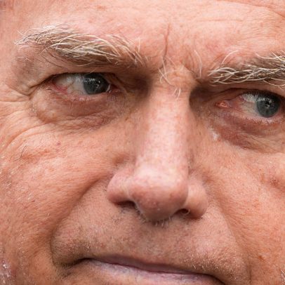 Ex-Presidente Jair Bolsonaro internado em cuidados intensivos