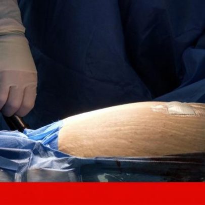 Comparticipação de fármacos e incentivos fiscais contra obesidade
