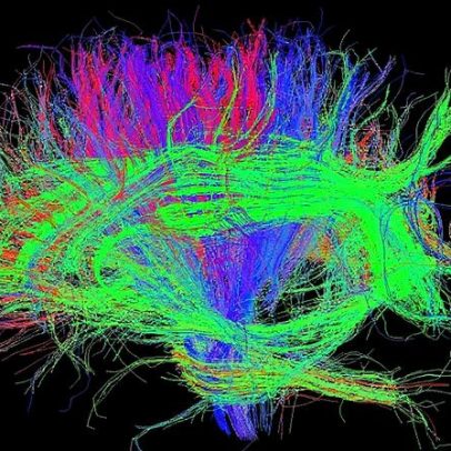 Equipa Champalimaud recebe financiamento para explorar fronteira da oncologia
