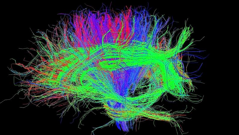 Vista lateral das ligações nervosas do cérebro humano