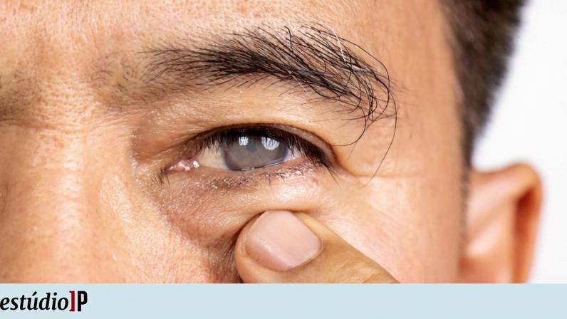 Alerta para o glaucoma: tudo o que precisa saber hoje