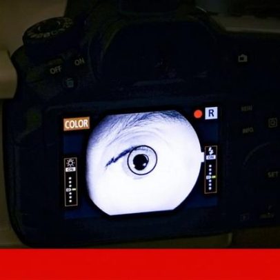 Jovem com problema oftalmológico passou por três urgências até ser vista por especialista