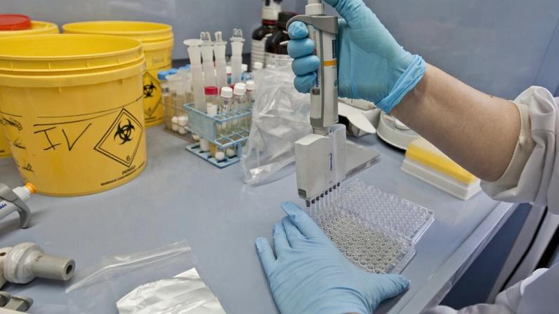 Exames de laboratório foram feitas pelo Instituto Nacional de Saúde Dr. Ricardo Jorge