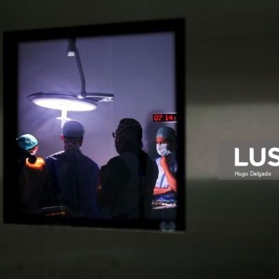 Regulador aponta mais de 30% dos utentes operados fora de tempo