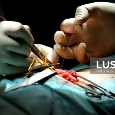 Mais de 13.400 utentes aguardavam cirurgia nos Açores no fim de fevereiro