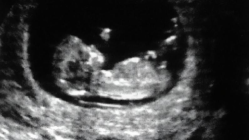 Enfermeiros especialistas monitorizam gravidez de baixo risco em 12 ULs de Saúde