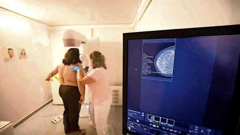 Este ano já foram realizados mais de 154 mil rastreios de cancro da mama