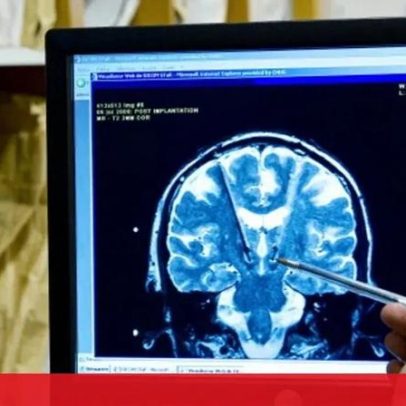 Má ligação entre o sistema digestivo e o cérebro prejudica a memória