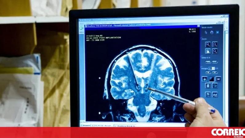 Má ligação entre o sistema digestivo e o cérebro prejudica a memória