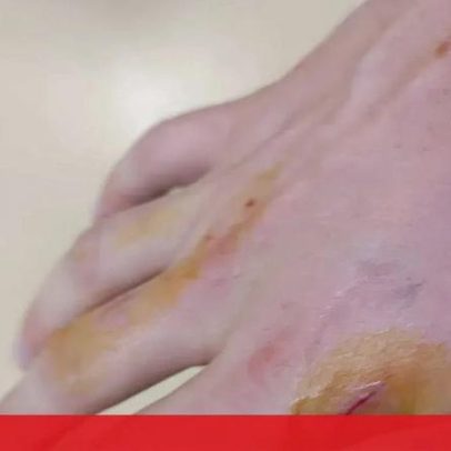 Pode enfrentar prisão por apedrejar e morder dois polícias em Matosinhos