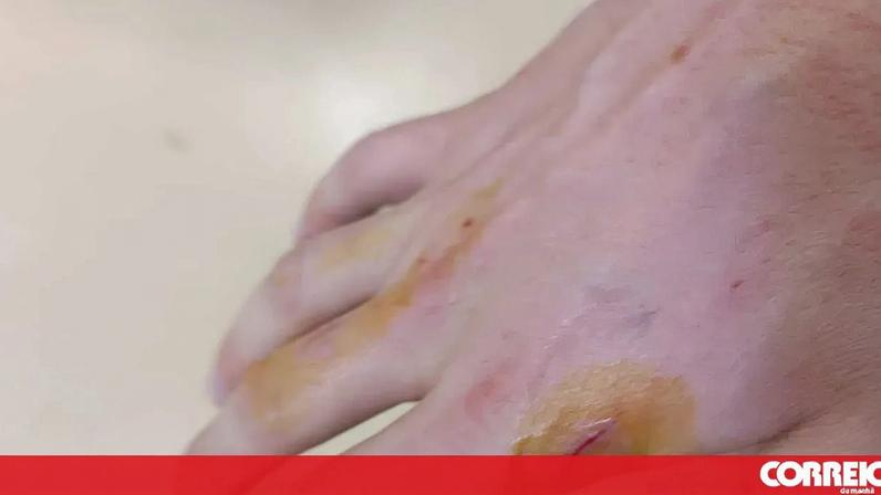 Pode enfrentar prisão por apedrejar e morder dois polícias em Matosinhos