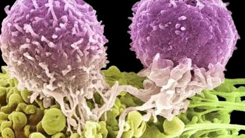 Células cancerígenas