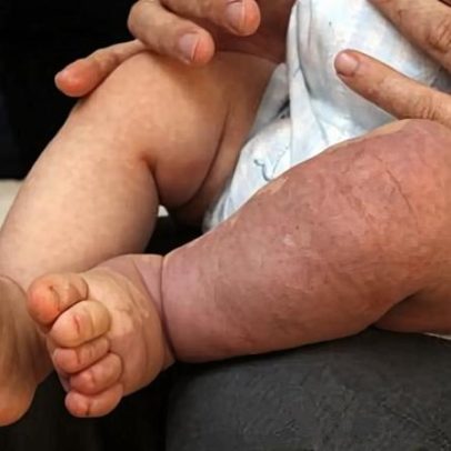 Mortalidade infantil em Portugal atinge níveis de países pobres em vários municípios