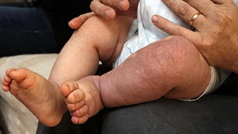 Após alguns anos de quebra, em 2024 a taxa de mortalidade infantil aumentou e no ano passado ficou praticamente inalterada