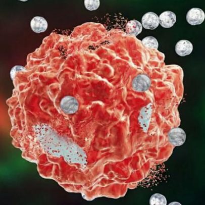 Investigação em Leiria visa ajudar diagnóstico de lesões cancerígenas na pele