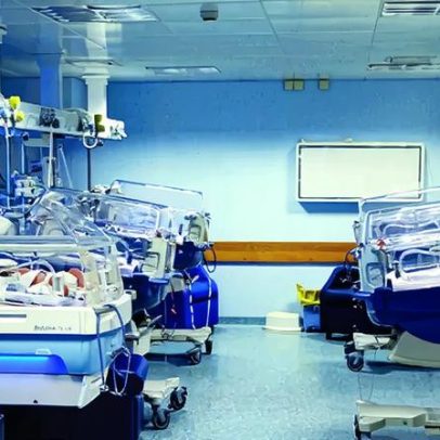 Portugueses estudam método para detectar risco de défice cognitivo após AVC