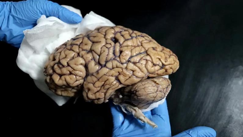 Associação alerta para falta de respostas a vítimas de danos cerebrais adquiridos