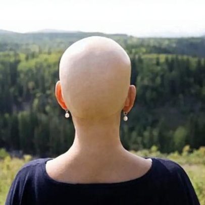 Silêncio do cancro colorretal complica diagnóstico precoce