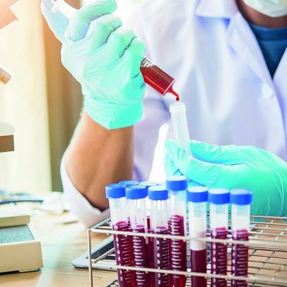 Cientistas reprogramam pela primeira vez células antitumorais