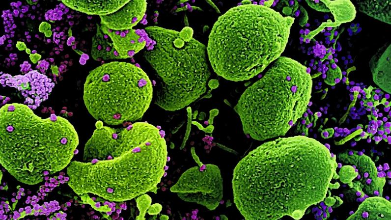 Coronavírus SARS-CoV-2 visto ao microscópio