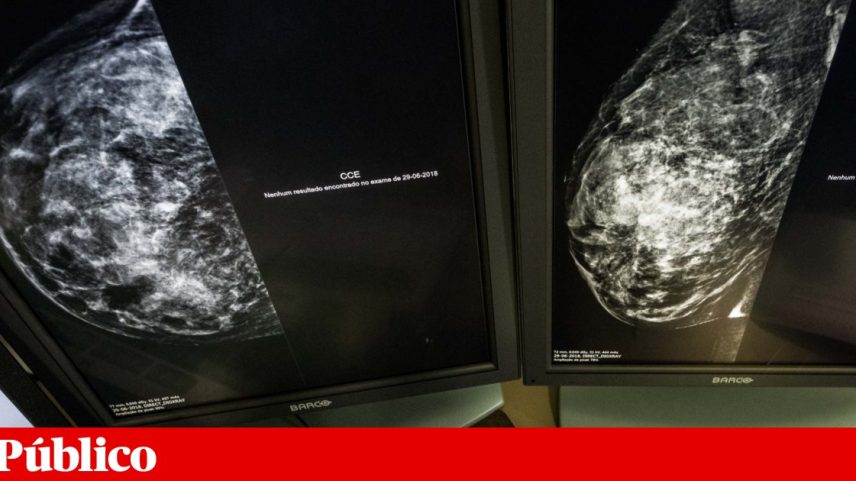 Foram analisadas mamografias e biópsias de mais de 500 mulheres