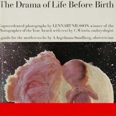 Arquivos do fotógrafo sueco Lennart Nilsson abertos a investigação e público