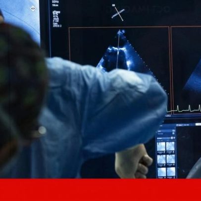 SNS continua como principal prestador; privados já somam um terço das consultas