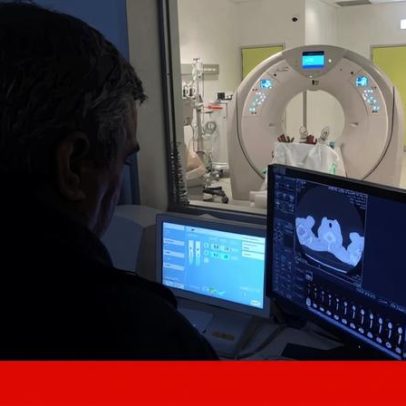 Rastreios do cancro do pulmão avançam nos hospitais de Gaia e Santa Maria