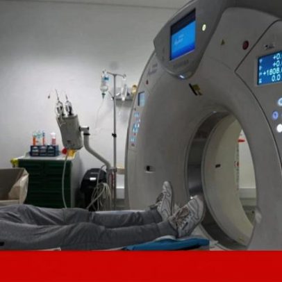 ULS Santo António e Câmara de Cascais propõem rastreio do cancro do pulmão