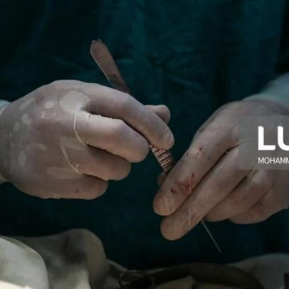 Cirurgias adicionais no Santa Maria pagas indevidamente a 28 profissionais