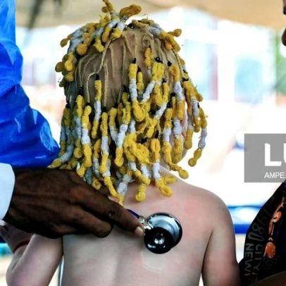 Sindicato alerta para aumento de doenças preveníveis em Angola e acusa o Governo