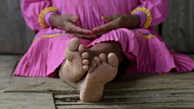 Mutilação genital de crianças indígenas na Colômbia é tema de preocupação