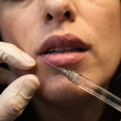 ASAE instaura 246 processos-crime a pessoas não habilitadas para pôr botox