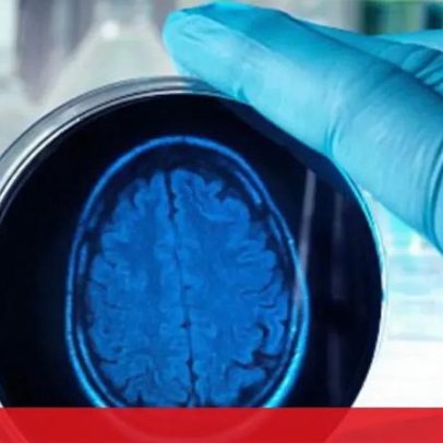 Investigadores criam plataforma de detecção precoce de Alzheimer pela voz