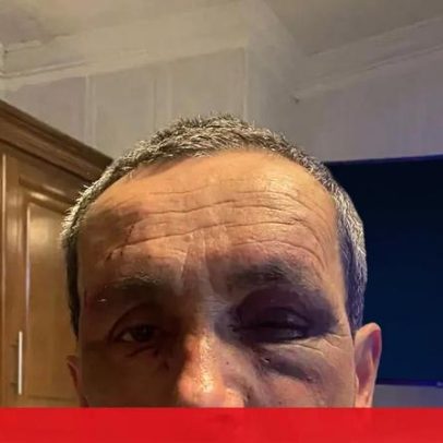 Homem agredido na sede do Rancho Folclórico de Freamunde