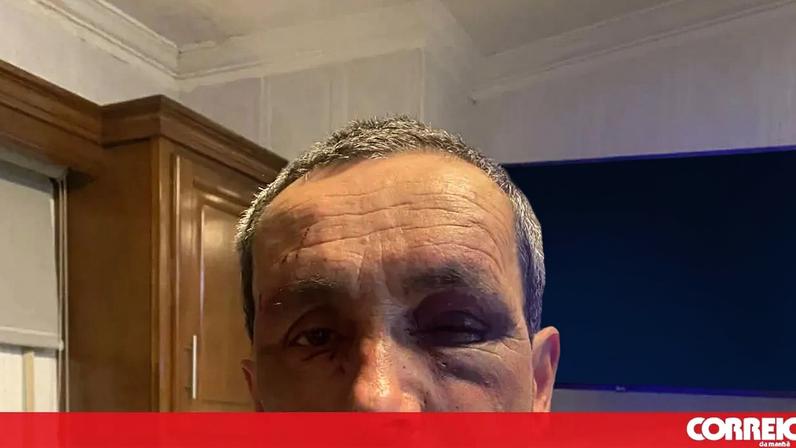 Homem agredido na sede do Rancho Folclórico de Freamunde