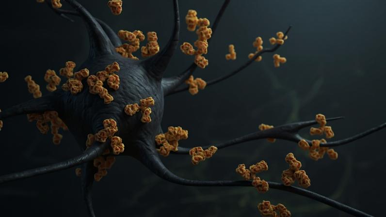 Esclerose Múltipla: Os anticorpos atacam os neurónios