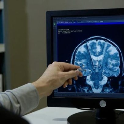 Regeneração cerebral em aves pode inspirar reparos no cérebro humano