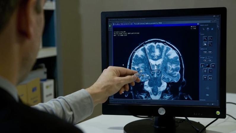 Regeneração cerebral em aves pode inspirar reparos no cérebro humano