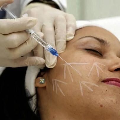 Quase 1000 denúncias de procedimentos estéticos não habilitados em nove anos