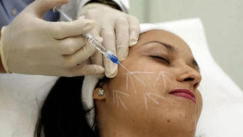 Cerca de 1000 denúncias de procedimentos estéticos por pessoas não habilitadas em nove anos