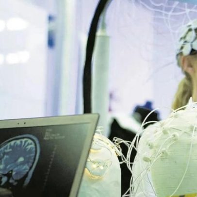 Estudo mostra eficácia quase nula de fármacos revolucionários contra o Alzheimer