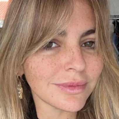 Jessica Athayde faz silicone e botox, mas evita falar das bochechas